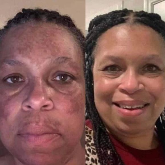 Two 180 Face Wash - Picture 5 of 14